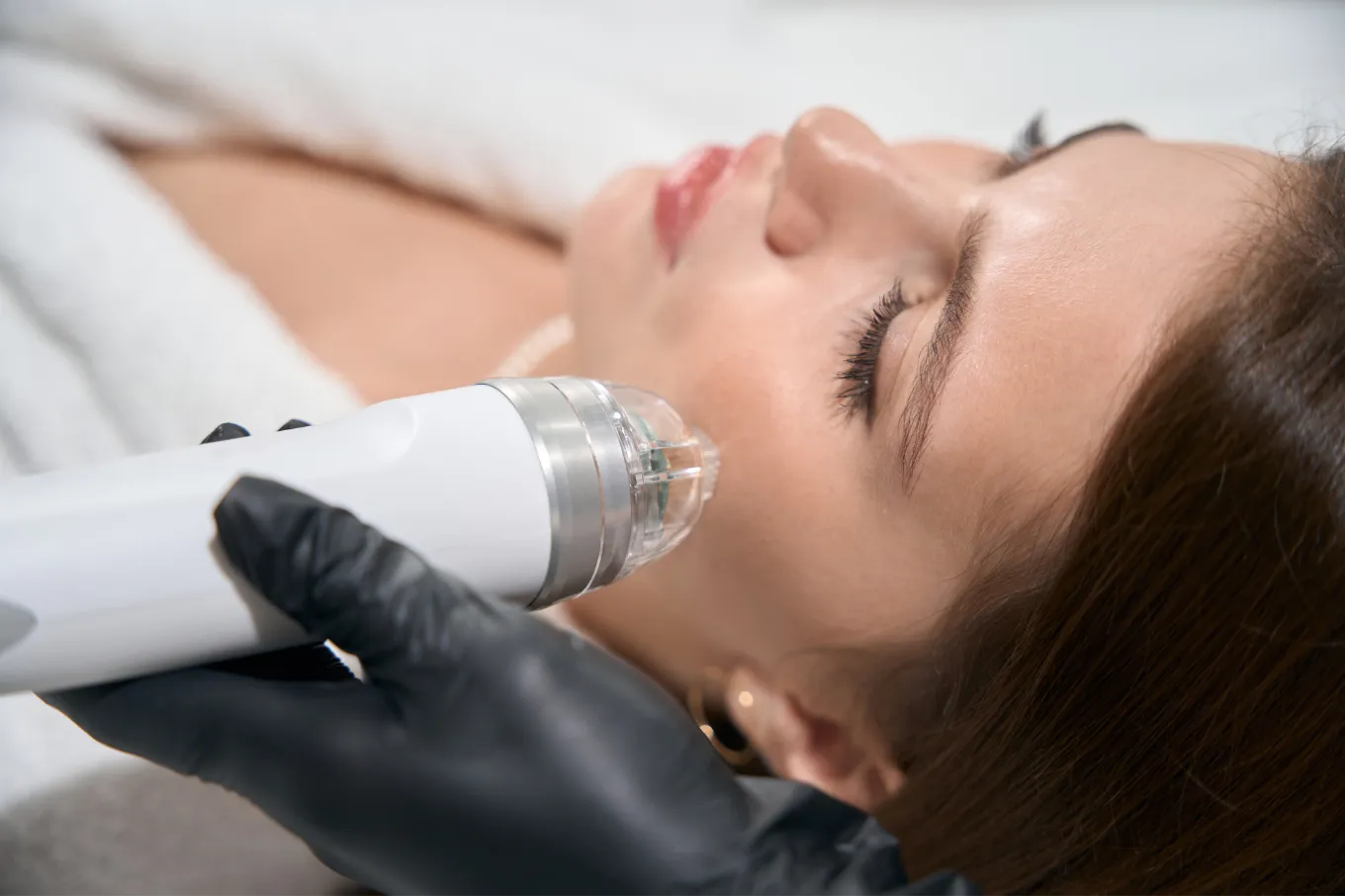 Advanced microneedling in a calm luxury medical spa setting